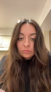 Why is my hair falling out??? #fyp #hairloss #foryou #foryoupage  #GEICOLipSync