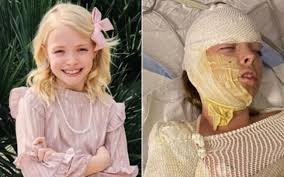 Girl, 10, in US left with severe burns to half her body after propane gas  tank explodes at party