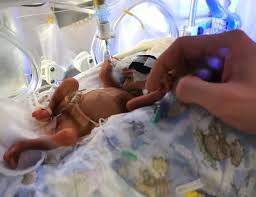 This is because their vital organs — like the heart and. Airdrie Baby Born At 22 Weeks Finally Leaves Hospital Bbc News