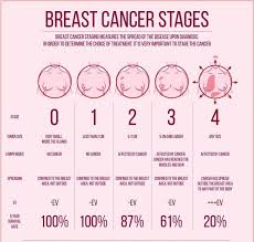 Image result for Breast Cancer Staging