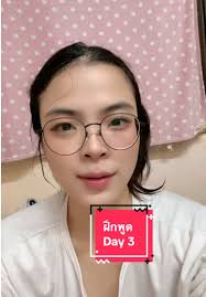 วันนี้ไปขูดหินปูนมาค่ะ #dysarthria #อาการพูดไม่เป็นความ  #spinocerabellarataxia #day3