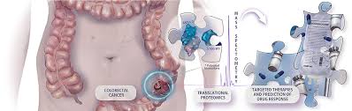 Depending on where exactly the cancer starts, bowel cancer is sometimes called colon or rectal cancer. Frontiers Biomarkers In Colorectal Cancer The Role Of Translational Proteomics Research Oncology