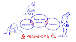 It particularly affects the person's ability to think. Lewy Body Dementia Youtube