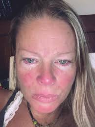 There's no back pain quite like this back pain: