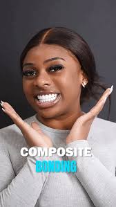 ✨Our valuable patient Ella Sylvia came to us from England for a one-day  Bonding and whitening treatment. She achieved the smile she desired without  any cuts or pain. We are pleased to