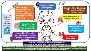 Image result for Multisystem Inflammatory Syndrome