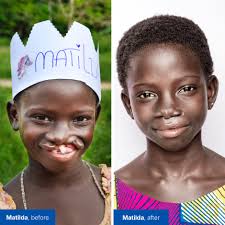 At school, Matilda was bullied mercilessly for her cleft lip. Although her  principal Mr. Biney tried to intervene, Matilda began to miss school to  avoid ridicule. One day, Mr. Biney saw a