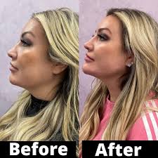 Get reviews, hours, directions, coupons and more for dolce aesthetics. Dolce Aesthetics Brooklyn New York Ny Skin Care Service Doctor Facebook