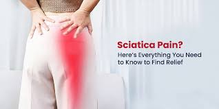 Image result for Sciatica