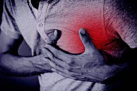 What is Heart Attack? - Indian Directory