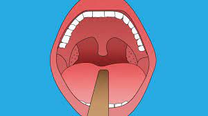Get the best price for a tonsillectomy with mdsave. Difference Between Tonsillectomy And Adenoidectomy Tonsils And Adenoids Surgery Michigan Medicine