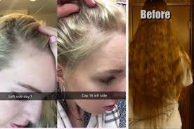 Hair serum can be used before you shampoo, after shampooing, or when styling your hair. 22 Hair Product Before And After Photos That Ll Make You Believe In Miracles