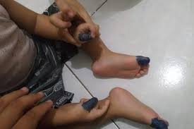 Gambar mewarnai pemandangan lembah dan pohon. Viral Tak Beri Obat Saat Anaknya Sakit Pria Ini Ngaku Spidol Biru Lebih Manjur Redakan Demam Warganet Kuliah Dokter Selama Ini Nggak Berarti Apa Apa Semua Halaman Nakita