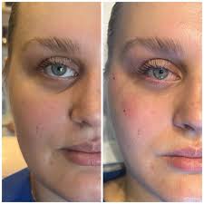 Miliona Aesthetic added a new photo —...