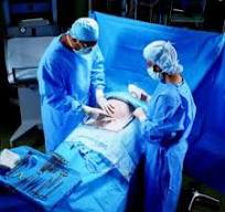 Halyard Health C-Section Drapes - C-Section Drape, Sterile, 100" x 72" x  120", 13" x 13" Adhesive Incise Area, Triangular Fenestration, 360° Fluid  ...