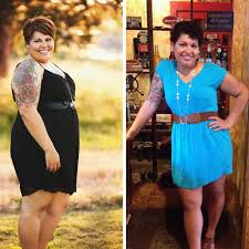 Pin On Gastric Life Change