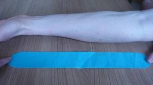 Wir gratulieren ihnen zu ihrer entscheidung. Golferarm Behandlung Therapie Ubungen
