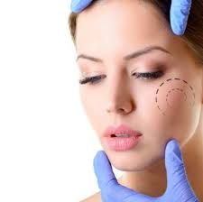 Bichectomy, commonly known as cheek thinning surgery, is a process of processing excess fat on the cheeks. Bichectomia Nova Cirugia Plastica