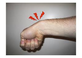 Les mouvements répétés, un traumatisme, de l'arthrose avec apparition de becs osseux provoquent un œdème des muscles de. Examen Clinique Centre De La Main Orleans