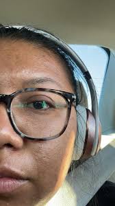 What are good suggestions or products to help with acne and textured skin?