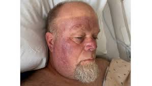 Fundraiser for Cynthia Fairman by Johnathyn Fairman Fairman : Donate to  Jeff Fairman's Recovery Fund