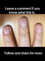 Image result for Mees Line