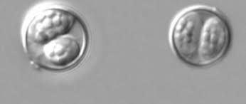 Image result for Cyclospora