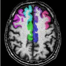 The anterior cingulate cortex (acc) lies on the medial aspect of the frontal lobes. Axial Mr Image Showing On The Left The Anterior Cingulate Cortex Download Scientific Diagram