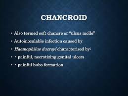 Image result for chancroid