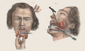 The Butchering Art by Lindsey Fitzharris review