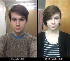 This stage here is when many turn back and get another chop. Male Hair Growth 6 Months Sablyan