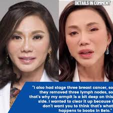 DRA. VICKY BELO PUMALAG SA MGA UMOKRAY SA KANYANG DIBDIB Nagbigay ng  pahayag ang kilalang celebrity doctor na si Dra. Vicki Belo hinggil sa mga  kritisismo at walang habas na puna na