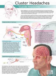 Pin By Jason Withington On Cluster Headache Cluster