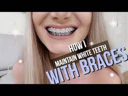 Pin On Teeth Whitening Coconut Oil