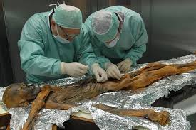 Kupfersteinzeit, die 1991 in den ötztaler alpen gefunden wurde. Kleidung Rekonstruiert Otzi Trug Ziegen Schafe Und Baren