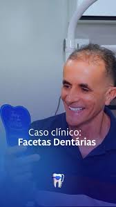 Sou dentista e o seu sorriso é o mais importante para mim" Dr Yohan e seu  paciente Alan Amaro. . . . #odontologia#ortodontia  #vemprasorriaimplantevctambem
