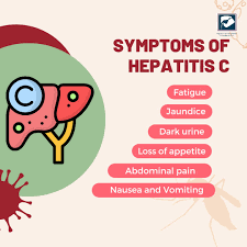 Image result for hepatitis symptoms