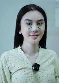 Khó nhận ra Lâm Khánh Chi sau màn “dao kéo” mới nhất