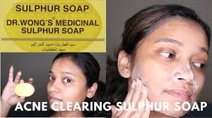 Sulfur is an essential element for life, and is widely found in areas of natural volcanic activity and hot springs. Dr Wong S Sulphur Soap For Acne Treatment And Clear Skin
