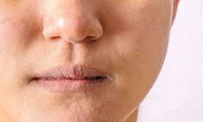 Your nasal airway is extremely vascular which enables it to become dried out easily by dry, cold air. Effective Ways To Treat A Dry Nose