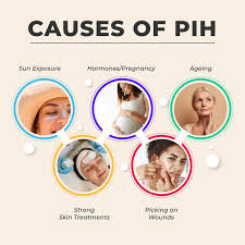Image result for Mild PIH Management