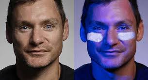 New skin cancer treatment greenlit for trials in CUH