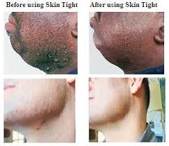 Wilkinson sword extra 2 sensitive razors for men. B C Products Annouces The Release Of Website And Online Catalog For Skin Tight Skin Care System And Janol Universal Hair Care System