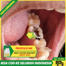 We did not find results for: Obat Sakit Gigi Berlubang Sariawan Bau Mulut Radang Tenggorokan Amandel Propolis Sm Herbal Shopee Indonesia