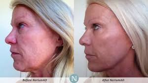 Real Results With Nerium S Night Cream There S No Better Time To Take Care Of Your Skin Than Right Now I Am Offering Nerium Anti Aging Treatments Skin Care