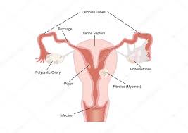 It can cause a variety of reproductive dysfunctions. Female Reproductive System Labelled Diagram 160842754 Larastock