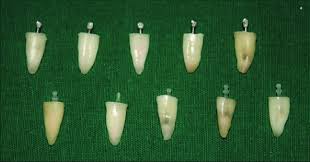Check spelling or type a new query. Cementation Of The Stainless Steel And Fibre Posts Using Paracore Dual Download Scientific Diagram