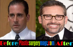 We did not find results for: Steve Carell Plastic Surgery Hair Transplant Plastic Surgery Magazine
