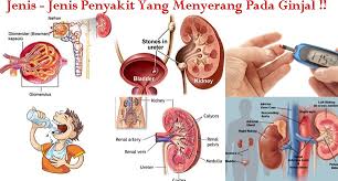 Maybe you would like to learn more about one of these? Sebaiknya Anda Berhati Hati Dengan Gejala Sakti Ginjal Kronik Ini Forum Diskusi Bisnis Online Maxmanroe
