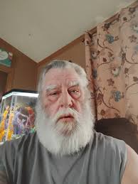 before and after. much better after. 7892661 DEC DEC 2025 အ်းမင်မ်သြိံ့ထ်ကခါ